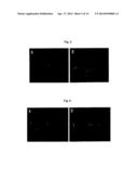 METHOD FOR TREATING VASCULAR-RELATED DISEASE diagram and image