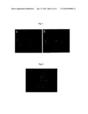 METHOD FOR TREATING VASCULAR-RELATED DISEASE diagram and image