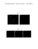 METHOD FOR TREATING VASCULAR-RELATED DISEASE diagram and image