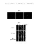 METHOD FOR TREATING VASCULAR-RELATED DISEASE diagram and image