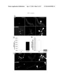 METHODS FOR TREATING PROSTATE CANCER diagram and image