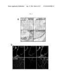 METHODS FOR TREATING PROSTATE CANCER diagram and image