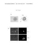 METHODS FOR TREATING PROSTATE CANCER diagram and image