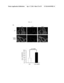 METHODS FOR TREATING PROSTATE CANCER diagram and image