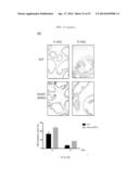 METHODS FOR TREATING PROSTATE CANCER diagram and image