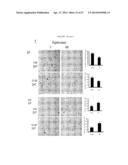 METHODS FOR TREATING PROSTATE CANCER diagram and image