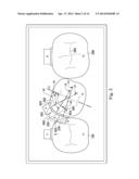 Sequential Modules for Computer Aided Bracketing Systems and Associated     Methods and Devices diagram and image