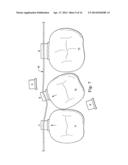 Sequential Modules for Computer Aided Bracketing Systems and Associated     Methods and Devices diagram and image