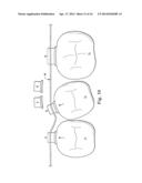 Sequential Modules for Computer Aided Bracketing Systems and Associated     Methods and Devices diagram and image