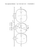 Sequential Modules for Computer Aided Bracketing Systems and Associated     Methods and Devices diagram and image