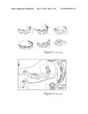 DENTAL BAR diagram and image