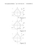 DENTAL BAR diagram and image