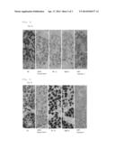 BIOMARKER FOR BREAST CANCER diagram and image