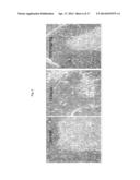 Beta-hydroxy-gamma-aminophosphonates for Treating Immune Disorders diagram and image