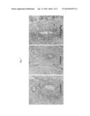 Beta-hydroxy-gamma-aminophosphonates for Treating Immune Disorders diagram and image