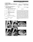 SERIES OF DRUGS USING PHOTOFRIN TO CATALYZE DECOMPOSITION OF HYDROGEN     PEROXIDE diagram and image