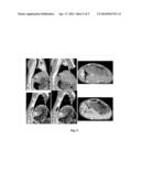 SERIES OF DRUGS USING PHOTOFRIN TO CATALYZE DECOMPOSITION OF HYDROGEN     PEROXIDE diagram and image