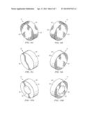 System and Methods for Treating Ear Disorders diagram and image