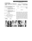 System and Method for Diagnosing Onset of Osteoarthritis diagram and image