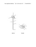 LAPAROSCOPIC DELIVERY  DEVICE diagram and image