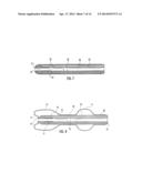 BALLOON ENCAPSULATED CATHETER TIP diagram and image