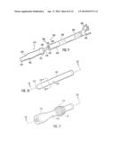 BALLOON ENCAPSULATED CATHETER TIP diagram and image