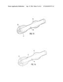 BALLOON ENCAPSULATED CATHETER TIP diagram and image