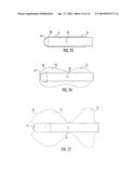 BALLOON ENCAPSULATED CATHETER TIP diagram and image