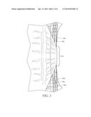 Combined Leg Cuff and Leg Gather diagram and image