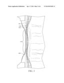 Combined Leg Cuff and Leg Gather diagram and image