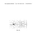 APPARATUS FOR TREATING TISSUE WITH MICROWAVE RADIATION AND ANTENNA     CALIBRATION SYSTEM AND METHOD diagram and image