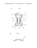 ORTHOPAEDIC PLATE AND SPREADER APPARATUSES AND METHODS diagram and image