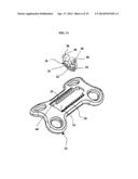 ORTHOPAEDIC PLATE AND SPREADER APPARATUSES AND METHODS diagram and image