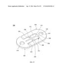 ORTHOPAEDIC PLATE AND SPREADER APPARATUSES AND METHODS diagram and image