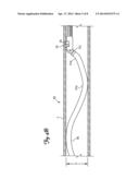 METHOD FOR MANIPULATING CATHETER SHAFT diagram and image