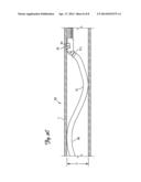 METHOD FOR MANIPULATING CATHETER SHAFT diagram and image