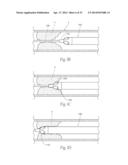 ATHERECTOMY DEVICES AND METHODS diagram and image