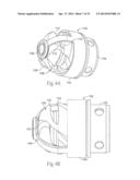 ATHERECTOMY DEVICES AND METHODS diagram and image