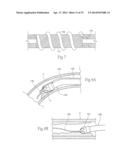 ATHERECTOMY DEVICES AND METHODS diagram and image