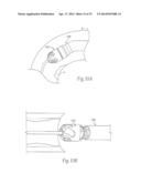 ATHERECTOMY DEVICES AND METHODS diagram and image