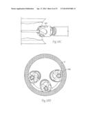 ATHERECTOMY DEVICES AND METHODS diagram and image