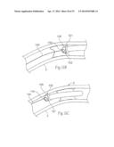 ATHERECTOMY DEVICES AND METHODS diagram and image