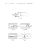 ATHERECTOMY DEVICES AND METHODS diagram and image