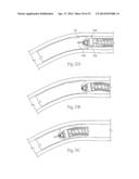 ATHERECTOMY DEVICES AND METHODS diagram and image