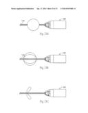 ATHERECTOMY DEVICES AND METHODS diagram and image