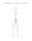 Guide-Wire Dilation Device for Facilitation of Lesion Crossing diagram and image