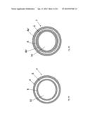 Guide-Wire Dilation Device for Facilitation of Lesion Crossing diagram and image