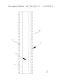 Guide-Wire Dilation Device for Facilitation of Lesion Crossing diagram and image