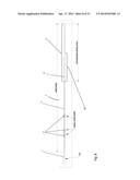 Guide-Wire Dilation Device for Facilitation of Lesion Crossing diagram and image