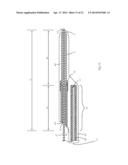 Guide-Wire Dilation Device for Facilitation of Lesion Crossing diagram and image